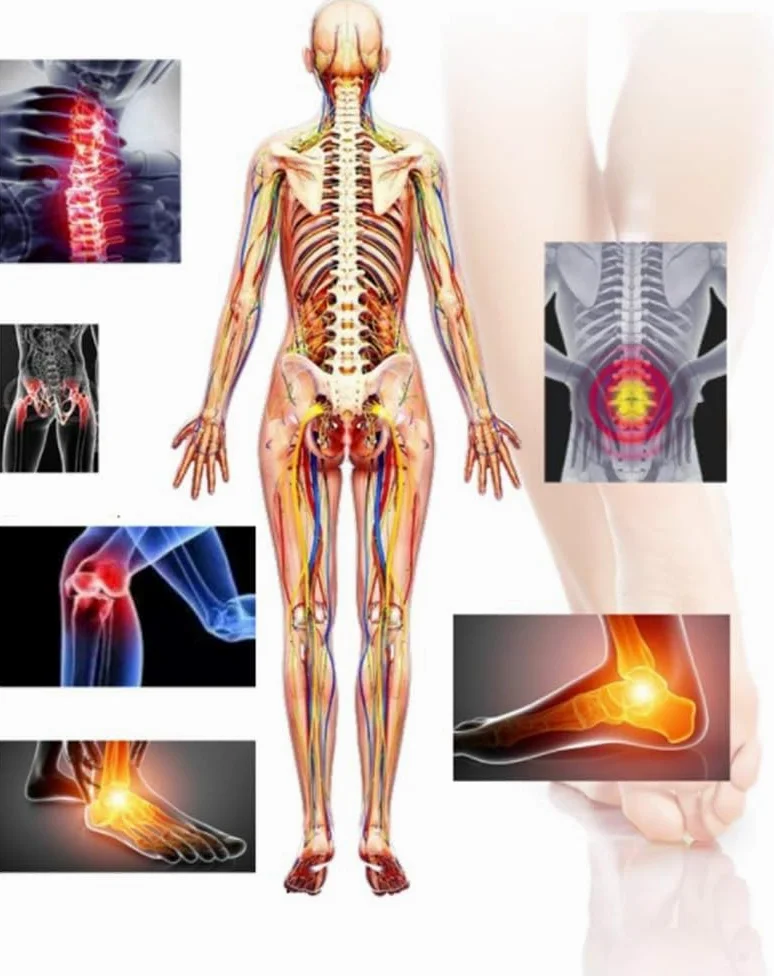 Solette Plantari Gambe Tipo X/o Inserti Ortopedici per Piedi Piatti, Fascite Plantare, Sperone Osseo, Sostegno, 43~44
